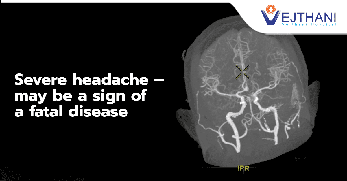 Severe Headache May Be A Sign Of A Fatal Disease Vejthani Hospital