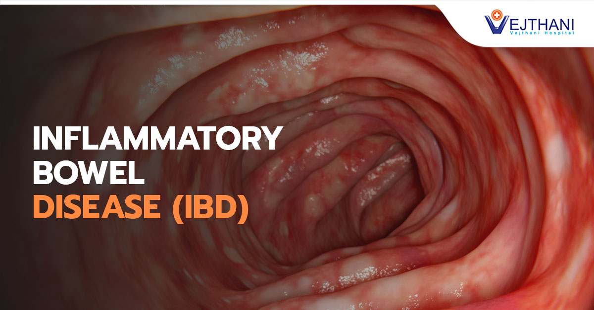 INFLAMMATORY BOWEL DISEASE (IBD)