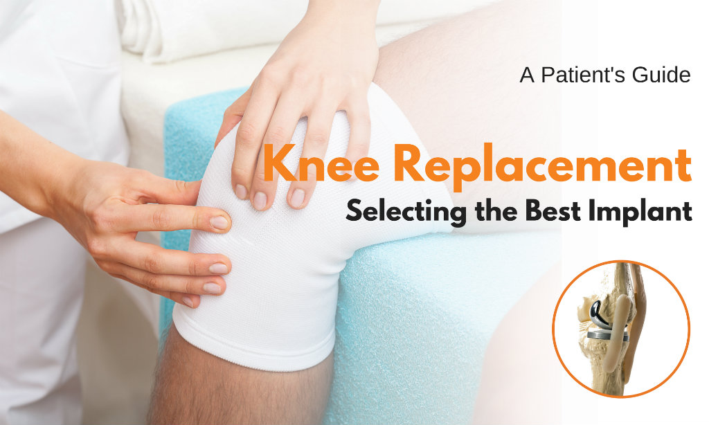 选择最佳膝关节置换植入物：患者指南