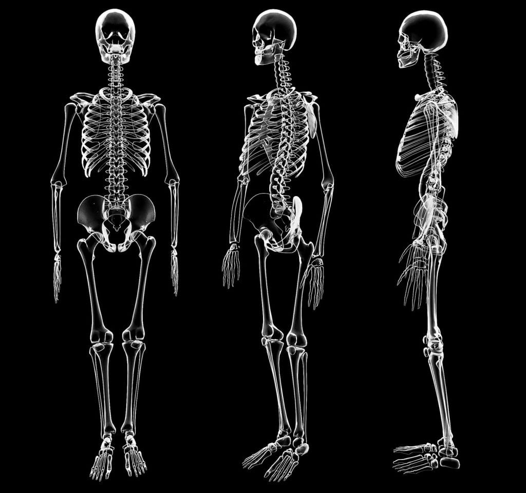 Osteoporosis : A Silent Killer of The Bones - Vejthani Hospital | JCI ...