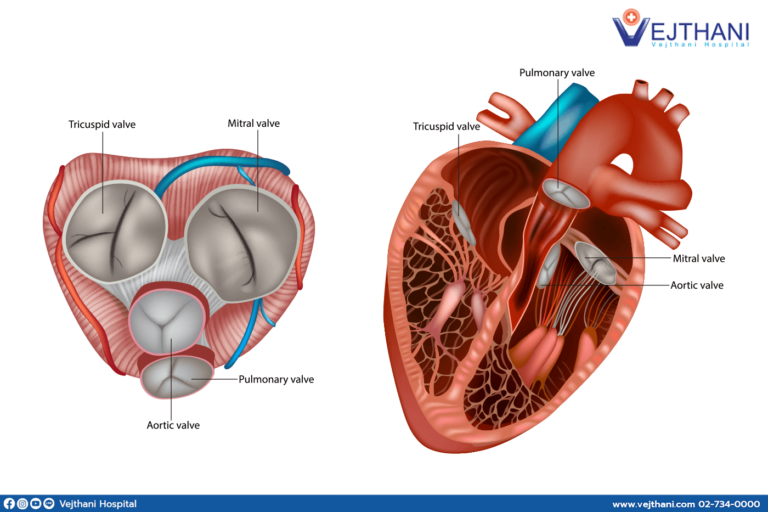 Doctors perform heart valve repair surgery at Vejthani Hospital.