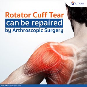 Rotator Cuff Tear can be repaired by Arthroscopic Surgery - Vejthani ...