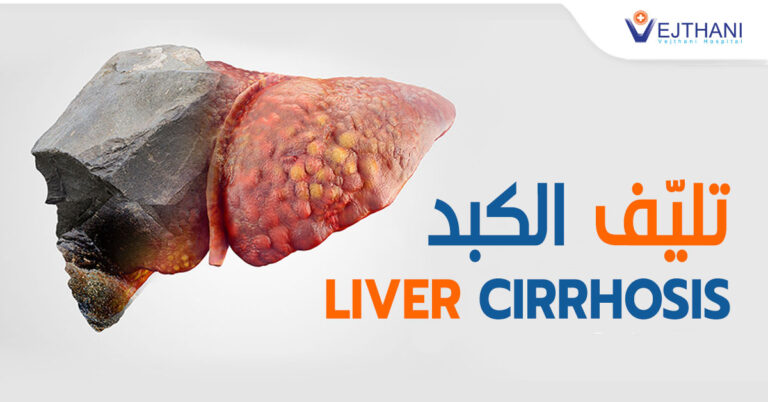 LIVER CIRRHOSIS