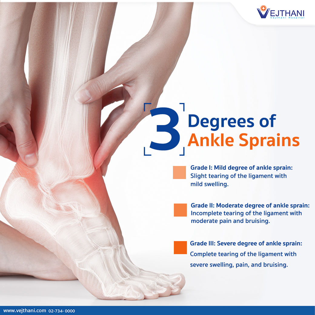 ankle sprain grades 1