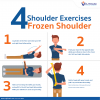 Warning Signs of Frozen Shoulder