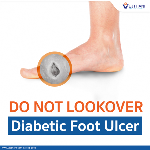 Do Not Overlook Diabetic Foot Ulcer