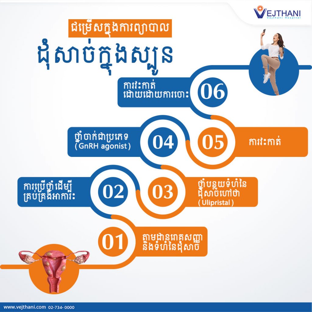 ជម្រើសក្នុងការព្យាបាល “ដុំសាច់ក្នុងស្បូន Uterine Fibroid” Vejthani Hospital Jci Accredited