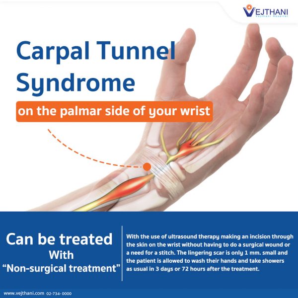 Non-surgical Treatment Option For Carpal Tunnel Syndrome - Vejthani 