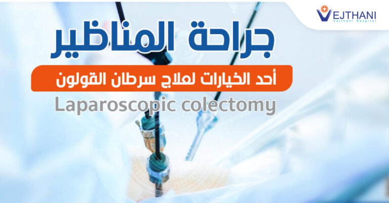 Laparoscopic colectomy