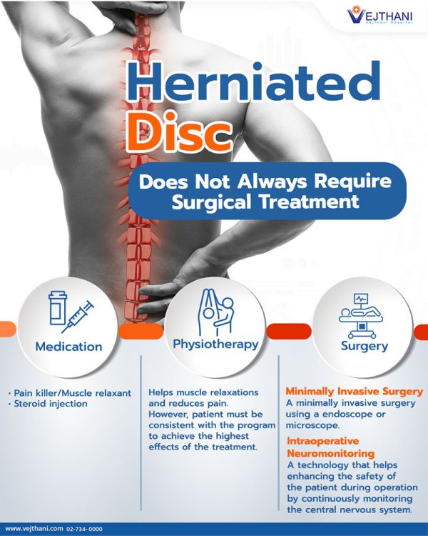 Herniated Disc Does Not Always Require a Surgical Treatment