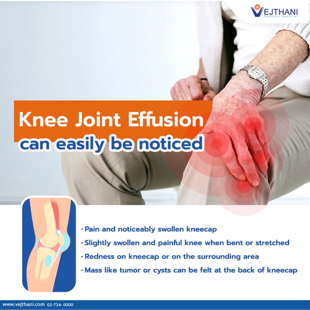 knee effusion