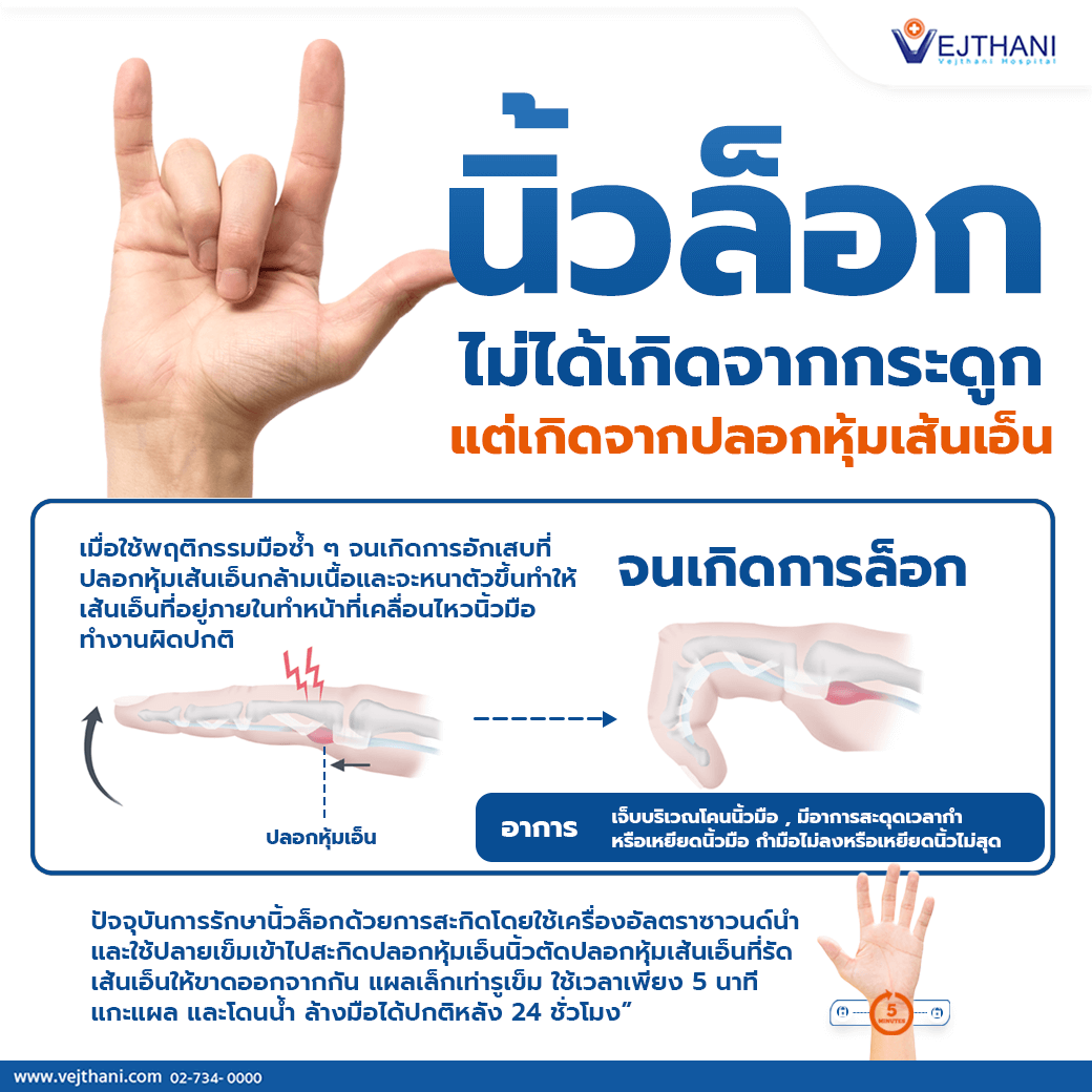 นิ้วล็อกไม่ได้เกิดจากกระดูก แต่เกิดจากปลอกหุ้มเอ็น - Vejthani Hospital