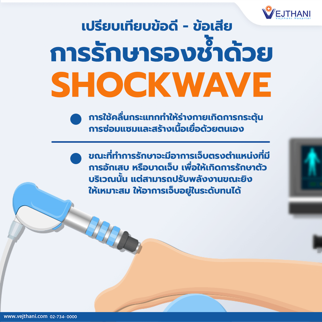 เปรียบเทียบข้อดี Vs ข้อเสีย รักษารองช้ำด้วย Shockwave (Eswt)