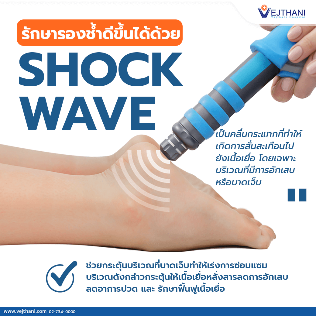 รักษารองช้ำดีขึ้นได้ด้วย SHOCK WAVE - Vejthani Hospital