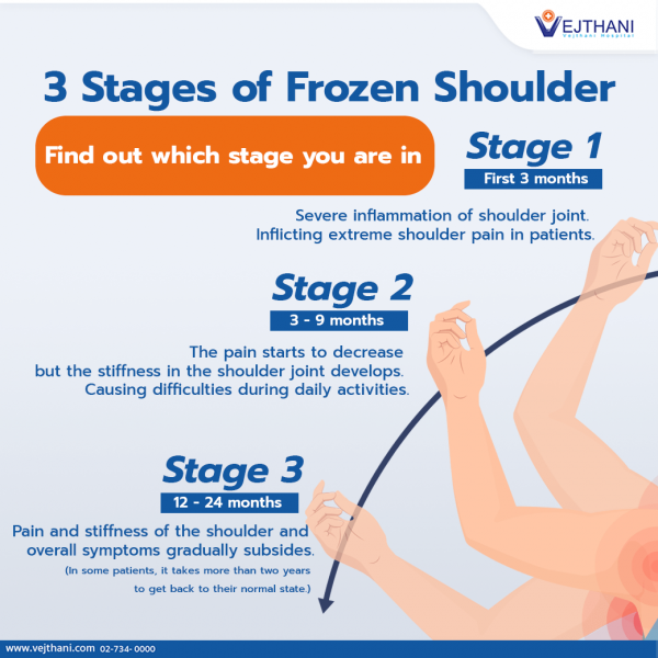 3 Stages of Frozen Shoulder – Find out which stage you are in ...