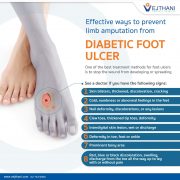 Effective ways to prevent limb amputation from Diabetic Foot Ulcer