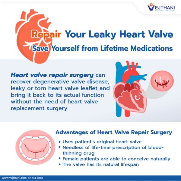 mitral-valve-replacement-surgery-steps-images-and-photos-finder