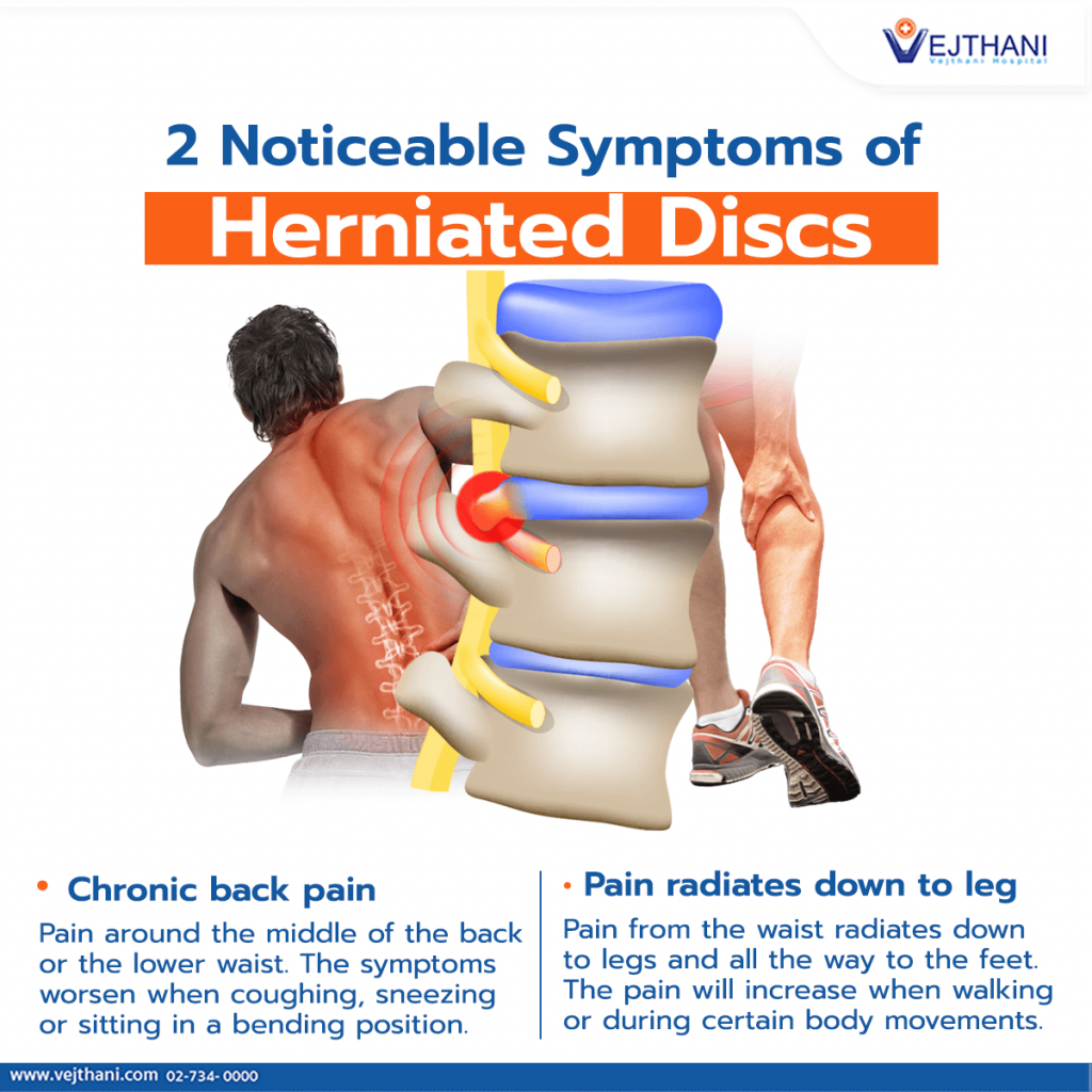 What Are The Causes And Symptoms Of A Disc Herniation Advanced The
