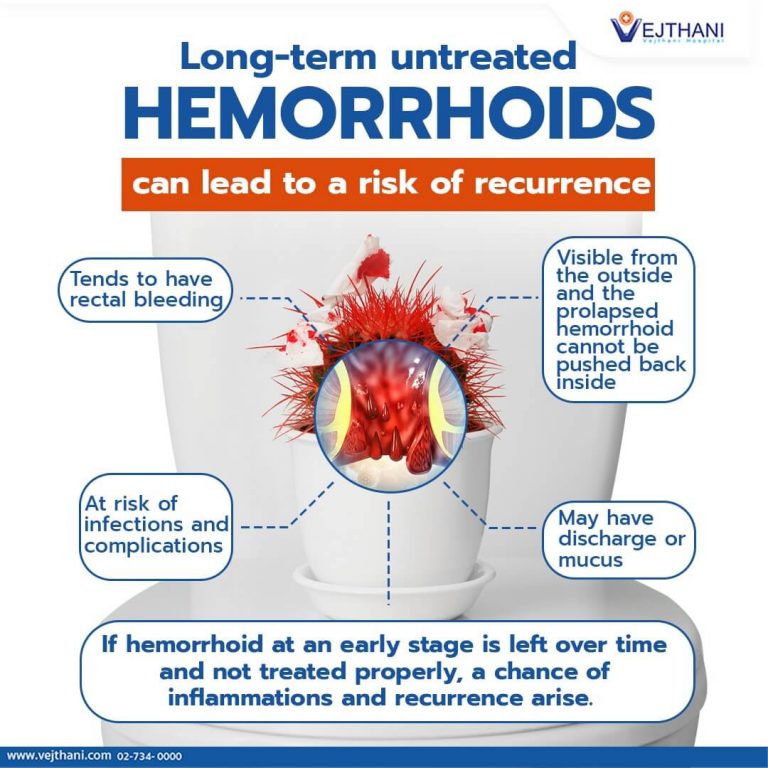 Long-term untreated Hemorrhoids can lead to a risk of recurrence ...