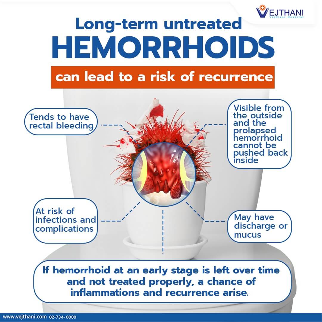 Long term Untreated Hemorrhoids Can Lead To A Risk Of Recurrence 