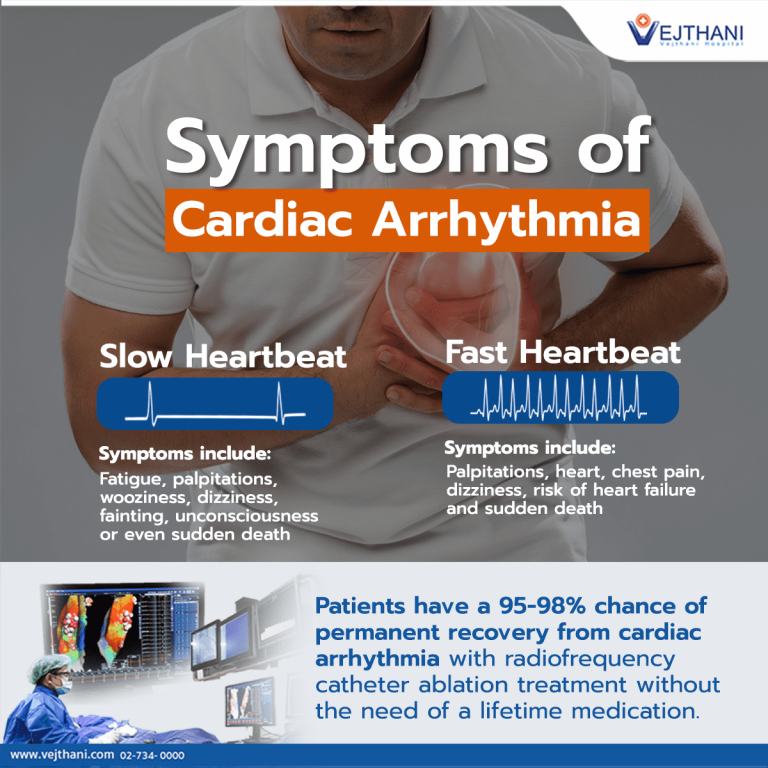 Cardiac Arrhythmia can be treated with Radiofrequency Ablation ...