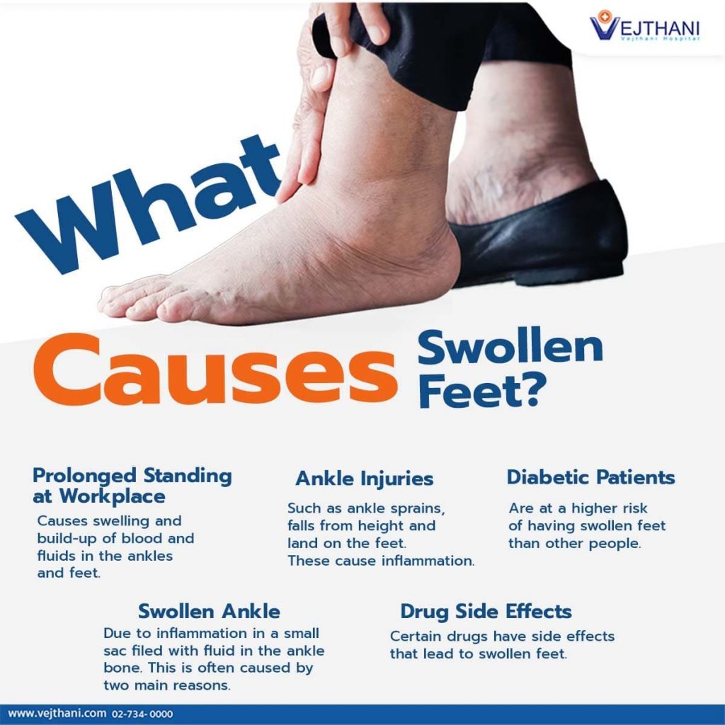 What Causes Swollen Feet Vejthani Hospital Jci Accredited International Hospital In Bangkok Thailand