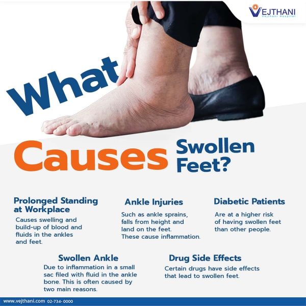 What Causes Swollen Feet? - Vejthani Hospital | JCI Accredited ...