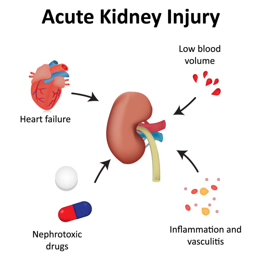 acute-kidney-failure-vejthani-hospital-jci-accredited-international