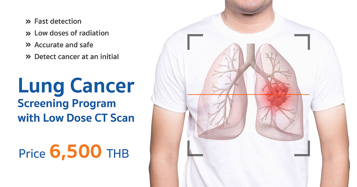 Lung Cancer Screening Program with Low Dose CT Scan - Vejthani Hospital