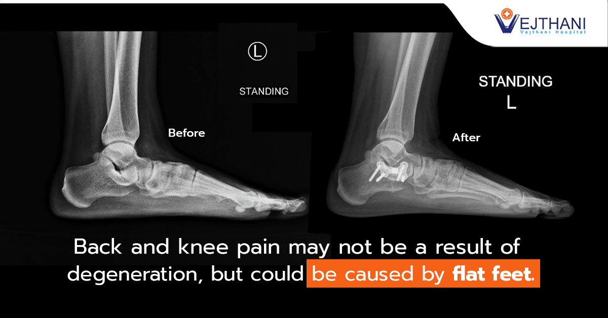 Knee and store foot pain