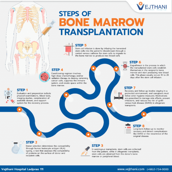 Steps Of Bone Marrow Transplantation - Vejthani Hospital | JCI ...