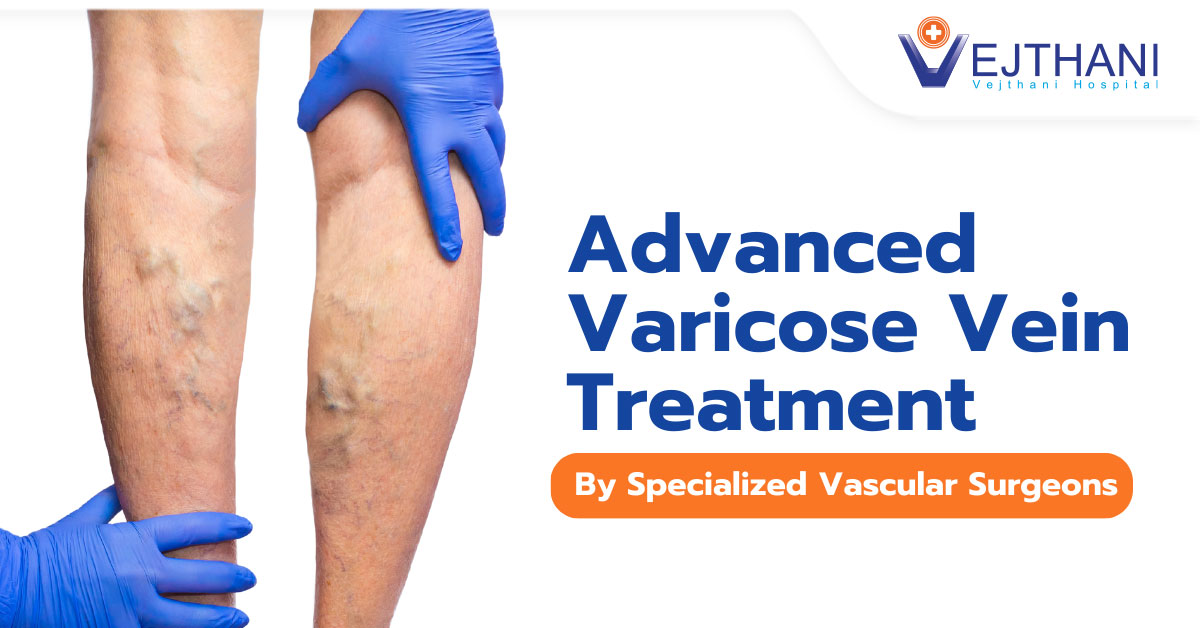 Trusted Specialists, Proven Results: Experience Advanced Varicose