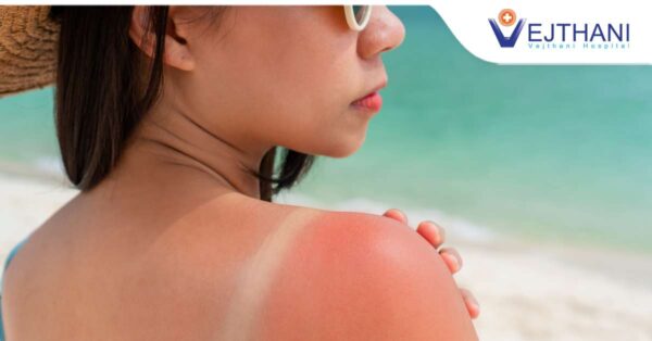 5 Simple Tips for Restoring Sun-Damaged Skin