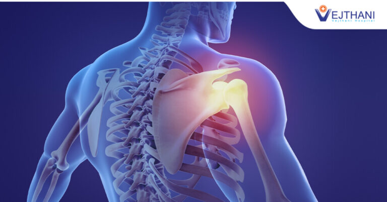 Shoulder Replacement Surgery in Thailand