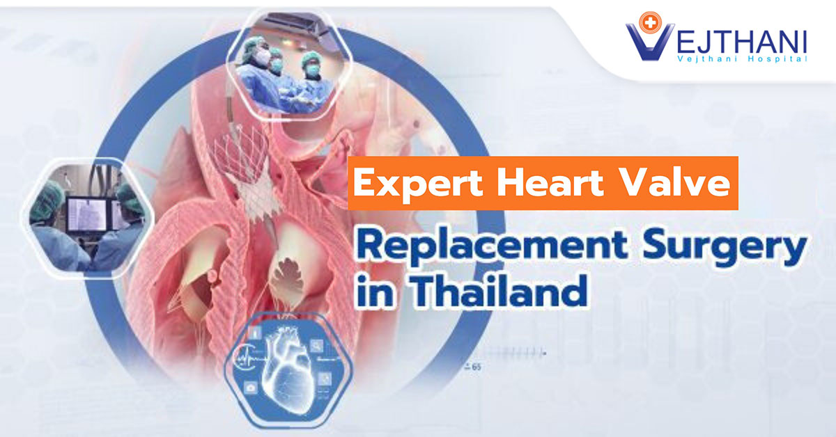 Expert Heart Valve Replacement Surgery