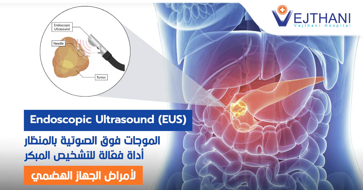 الموجات فوق الصوتية بالمنظار: أداة فعّالة للتشخيص المبكر لأمراض الجهاز الهضمي