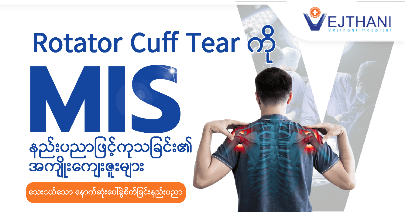  rotator cuff tear ကို MIS နည်းပညာဖြင့်ကုသခြင်း၏ အကျိုးကျေးဇူးများ