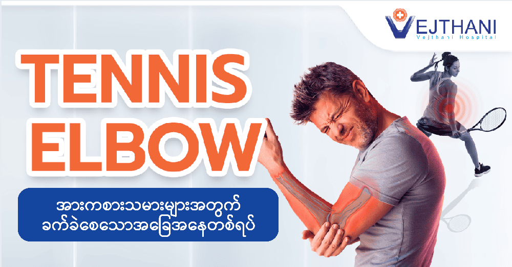  Tennis Elbow သည် အားကစားသမားများသာမက အလားတူလှုပ်ရှားမှုများတွင်လည်း စတင်ခံစားလာရသော ကျန်းမာရေးပြဿနာတစ်ခုဖြစ်သည်။