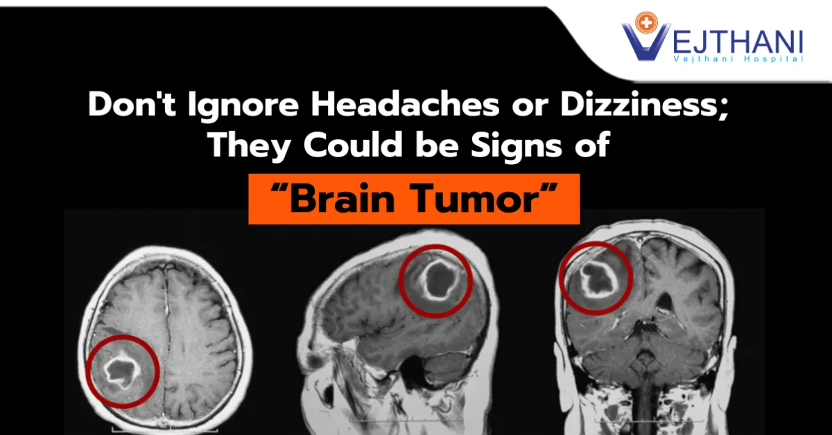 Don’t Ignore Headaches or Dizziness; They Could be Signs of Brain Tumor