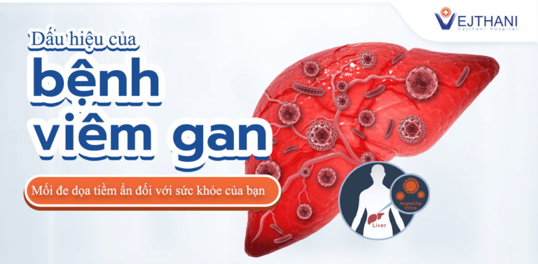 Dấu hiệu của viêm gan