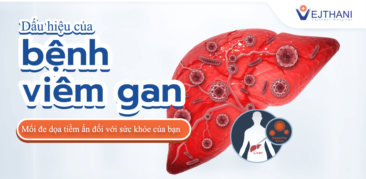 Dấu hiệu của viêm gan, mối đe dọa tiềm ẩn đối với sức khỏe của bạn