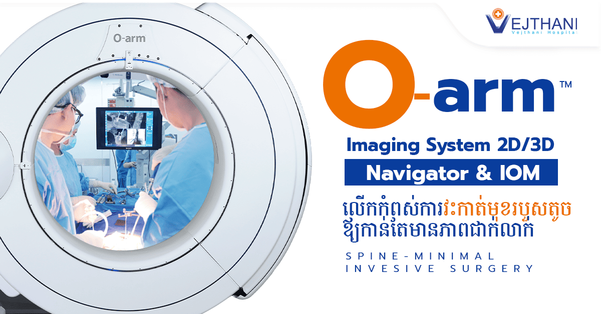 បច្ចេកវិជ្ជា 3D X-ray O-Arm 3D Navigation