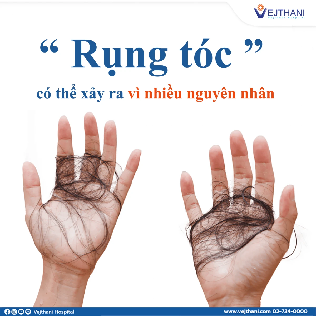 "Rụng tóc" xảy ra do nhiều nguyên nhân