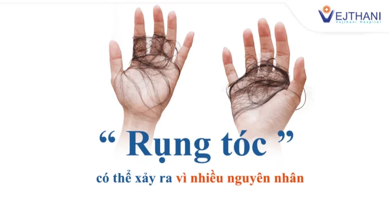 "Rụng tóc" xảy ra do nhiều nguyên nhân