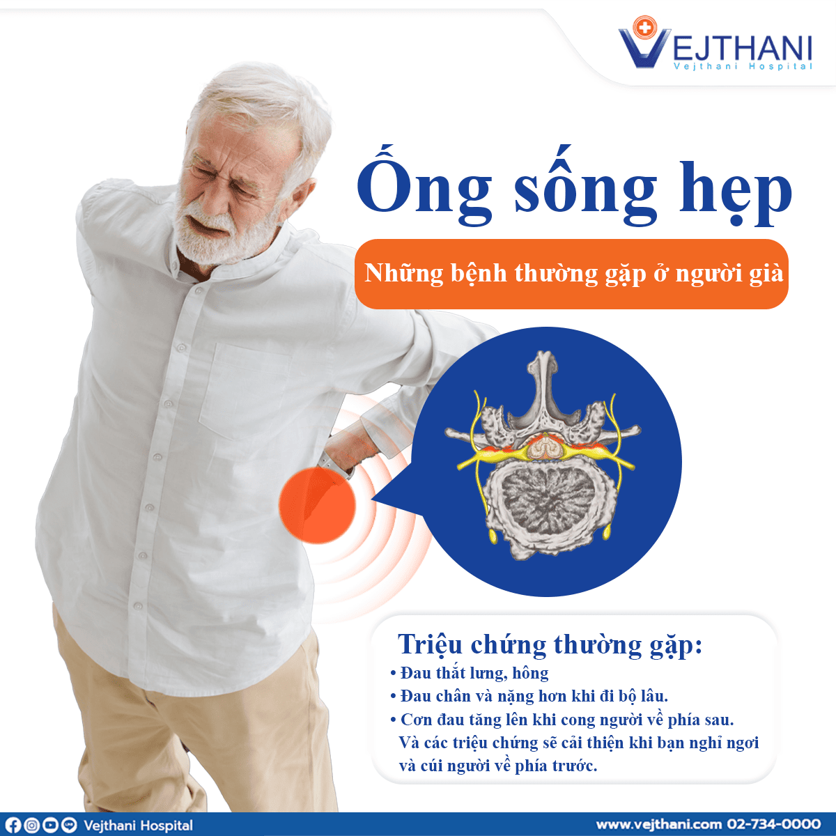 Hẹp ống sống
