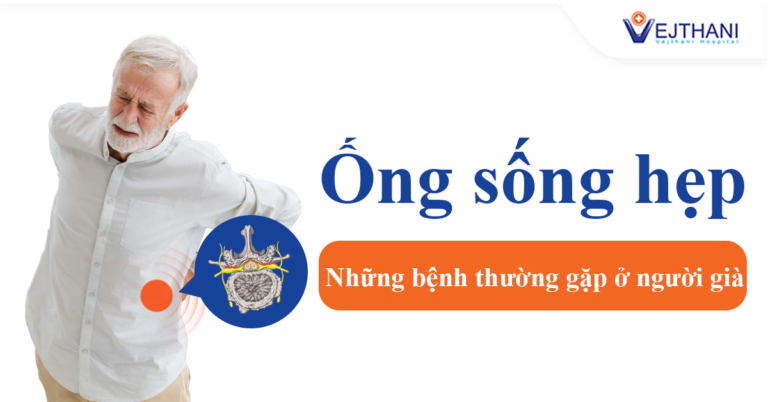 Hẹp ống sống