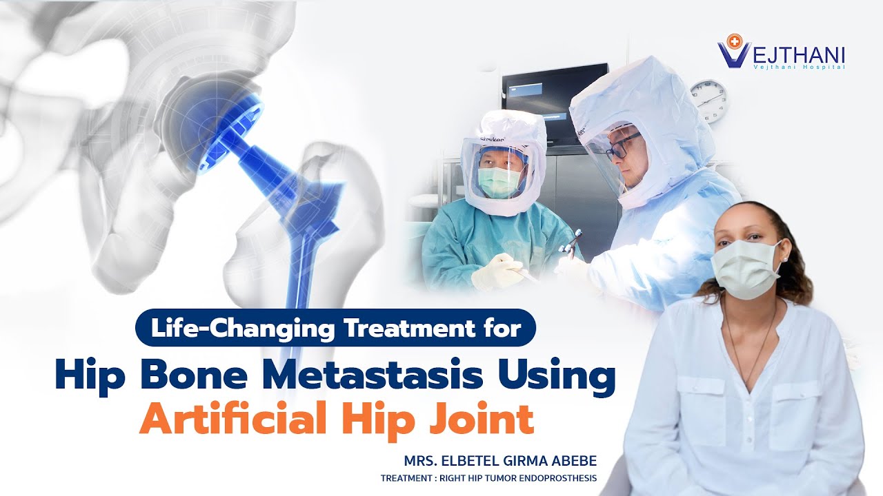 Life Changing Treatment for Hip Bone Metastasis Using Artificial Hip Joint