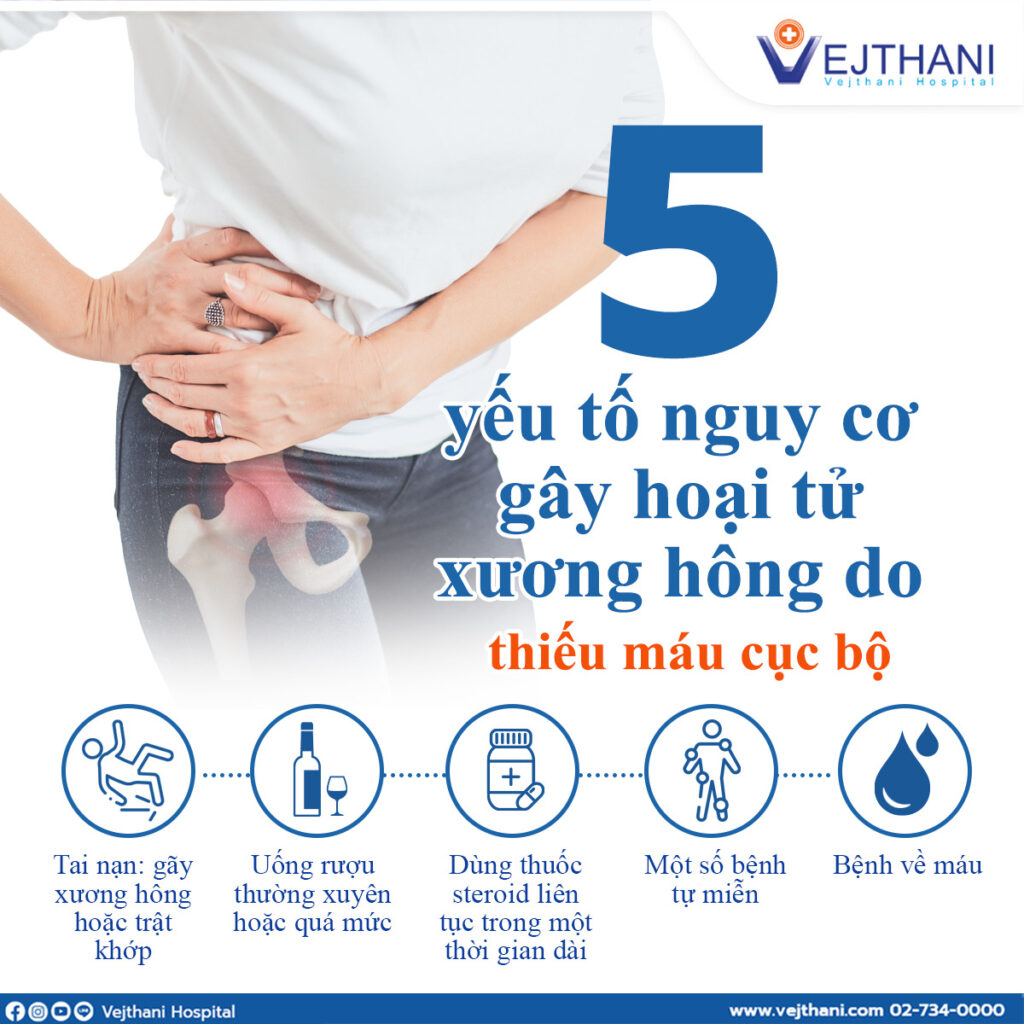 hoại tử vô mạch chỏm xương đùi  Trung tâm Phục hồi Thoái hóa Khớp, Bệnh viện Vejthani