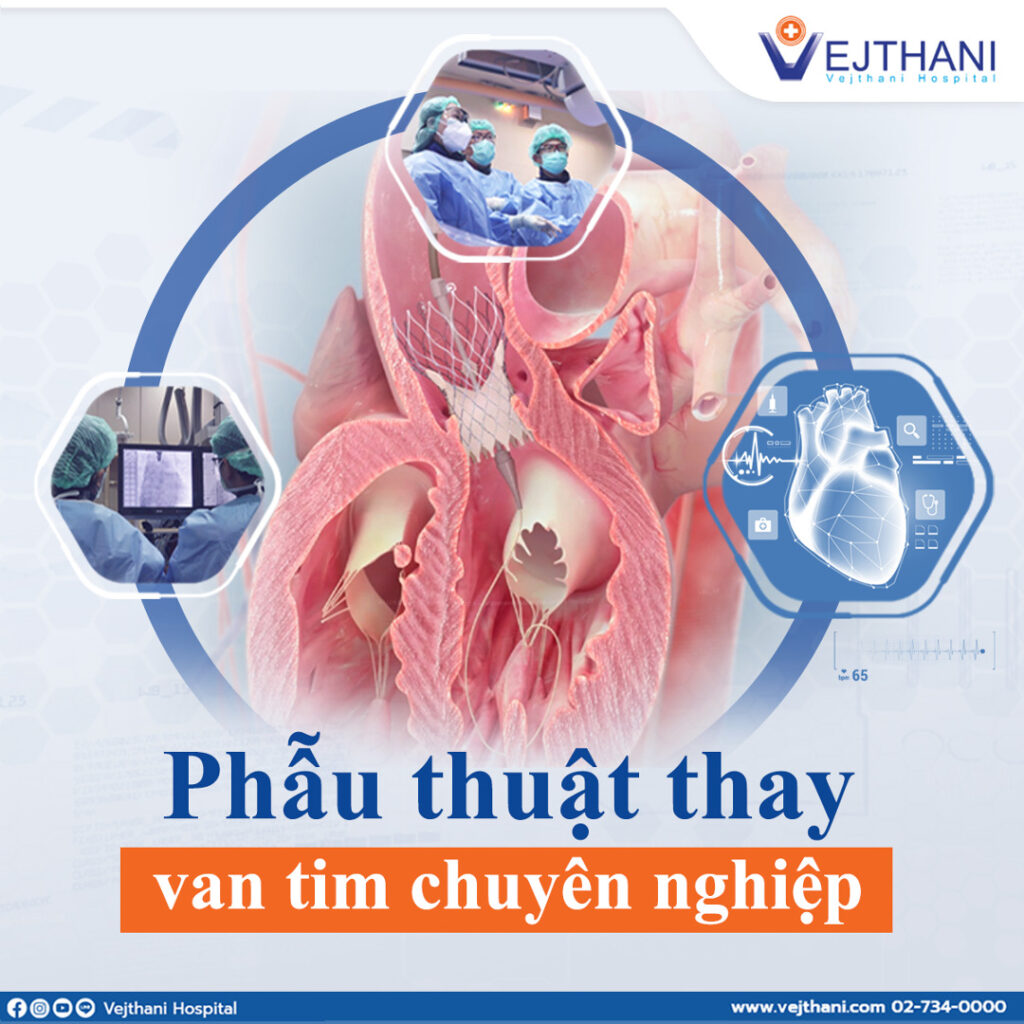 Phẫu thuật thay van tim Trung tâm Tim mạch, Tầng 5, Bệnh viện Vejthani