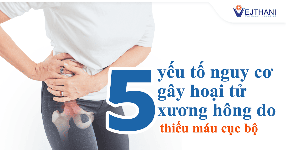 5 Yếu tố nguy cơ gây hoại tử vô mạch chỏm xương đùi